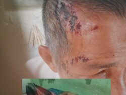 Perbaikan Jalan Lintas Provinsi “Tambal Sulam” Diduga Jadi Penyebab Kecelakaan, Warga Sungai Bengkal Jadi Korban